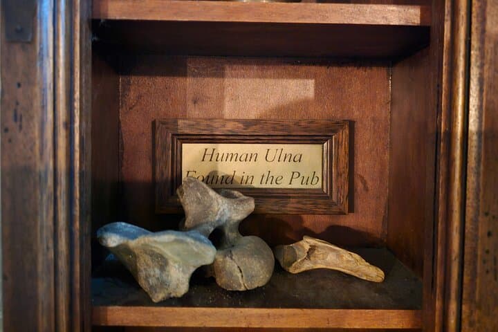 Human bone