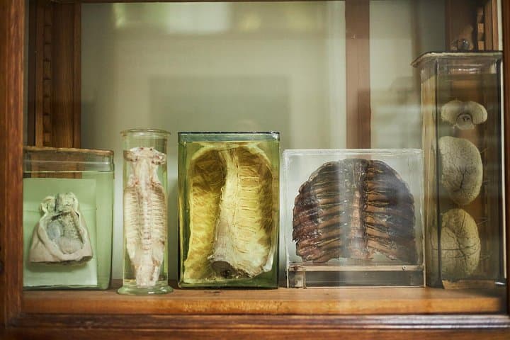 Surgeons' Hall Museums Private Guided Tour with Tickets